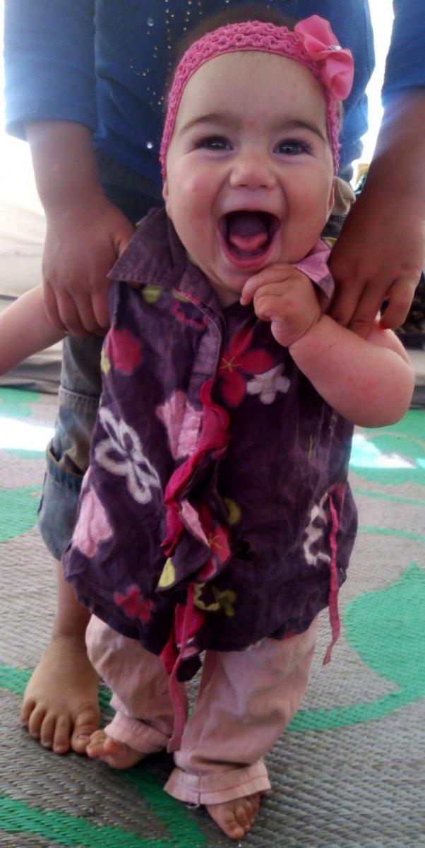 Suriyeli Delal bebek, yanıklarına rağmen hayata tutundu