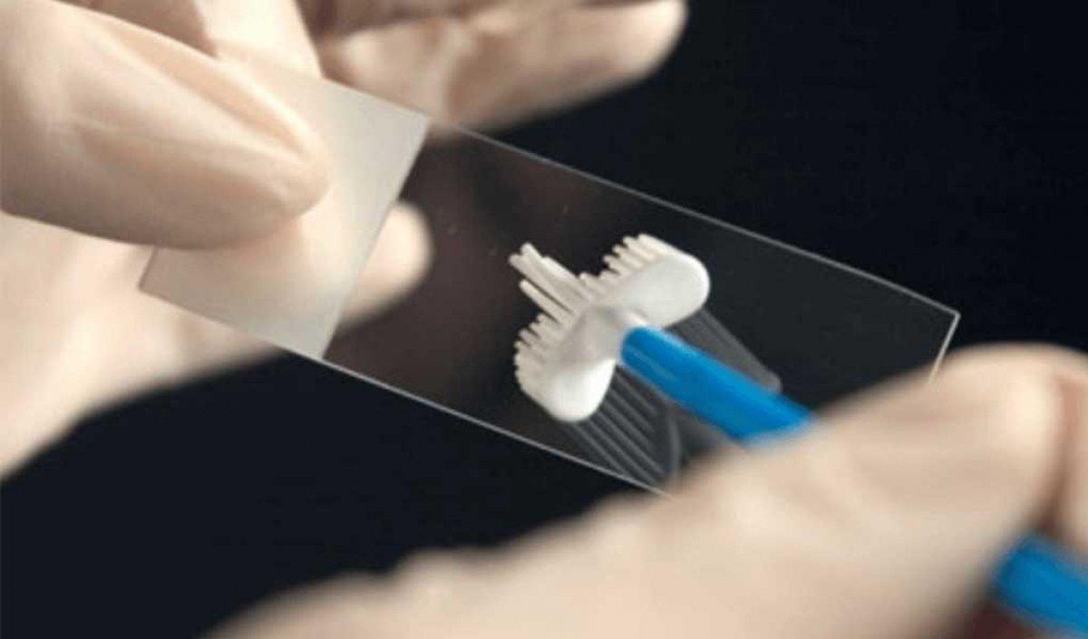 Kadınlarda en önemli tarama: Smear testi nedir