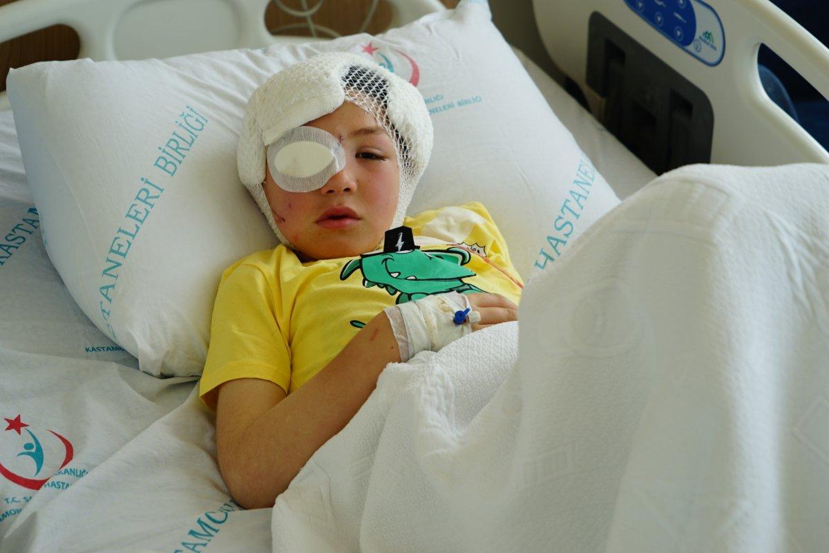 Kastamonu’da 8 yaşındaki çocuğa köpek saldırdı