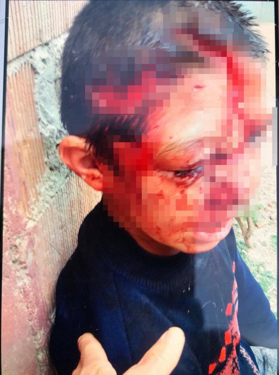 Kastamonu’da 8 yaşındaki çocuğa köpek saldırdı