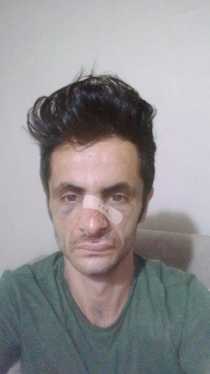 Yalova'da 'maske' uyarısı yapan çalışan darbedildi