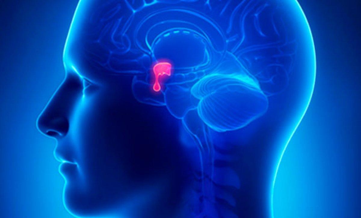 Migren ataklarına karşı 3 doğal tarif