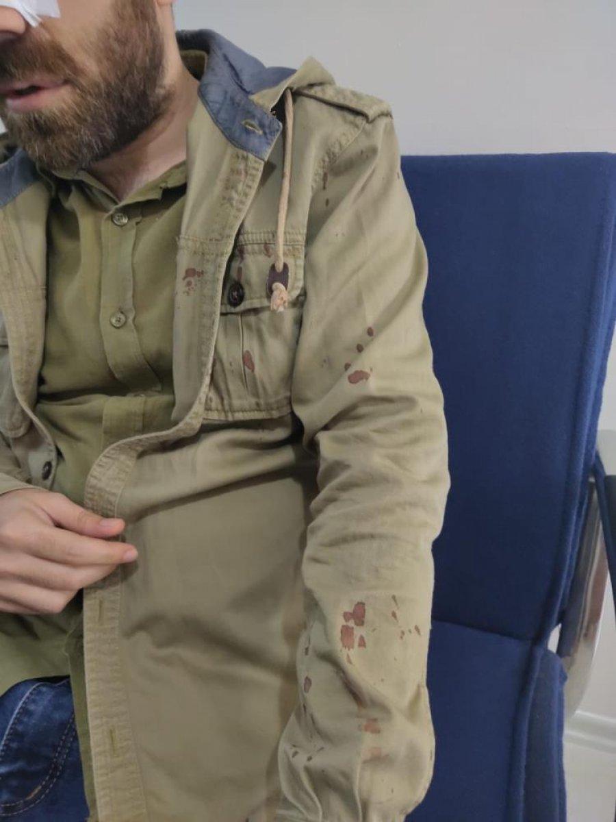 Kadıköy'de, aile hekimi sokak ortasında darbedildi