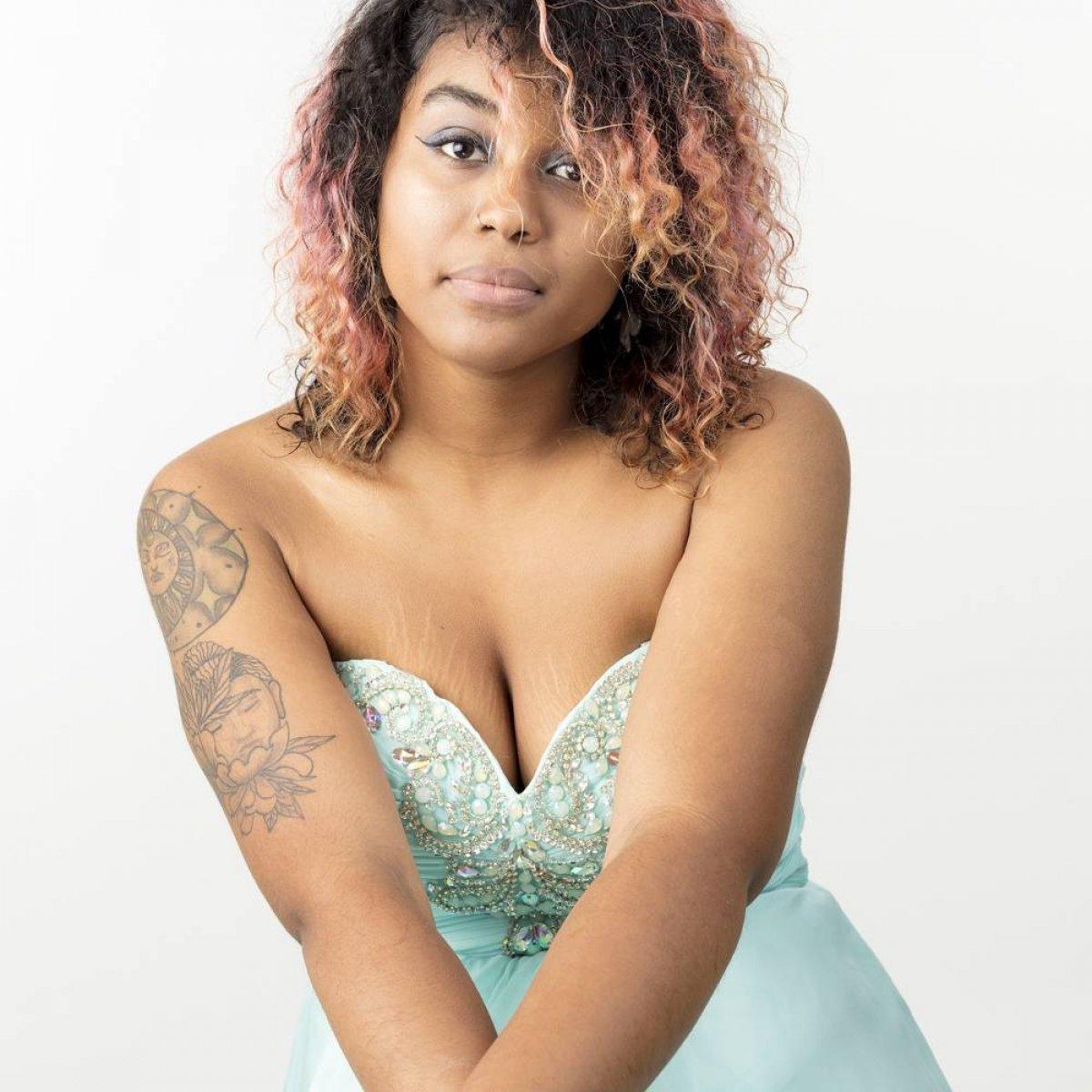 Doğuştan lenfödemli genç kadın görünüşüyle barışık yaşıyor