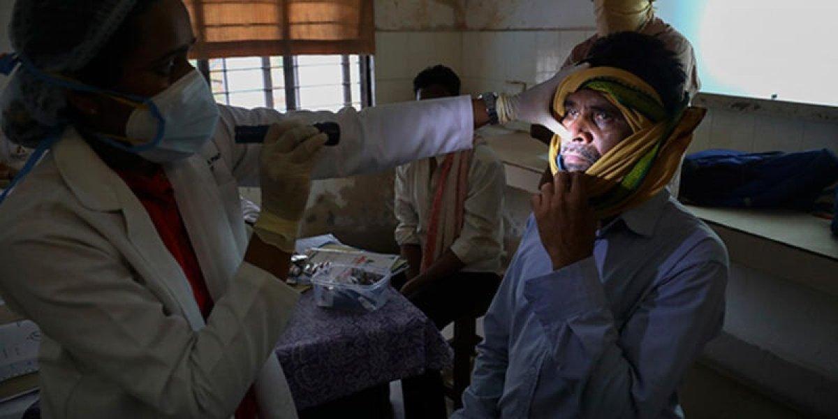 Kara mantar (Mukormikoz) hastalığı nedir, belirtileri nelerdir? Hindistan'ı alarma geçirdi..