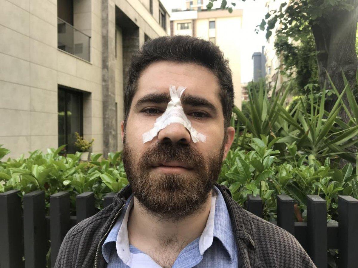 Kadıköy'de, aile hekimi sokak ortasında darbedildi