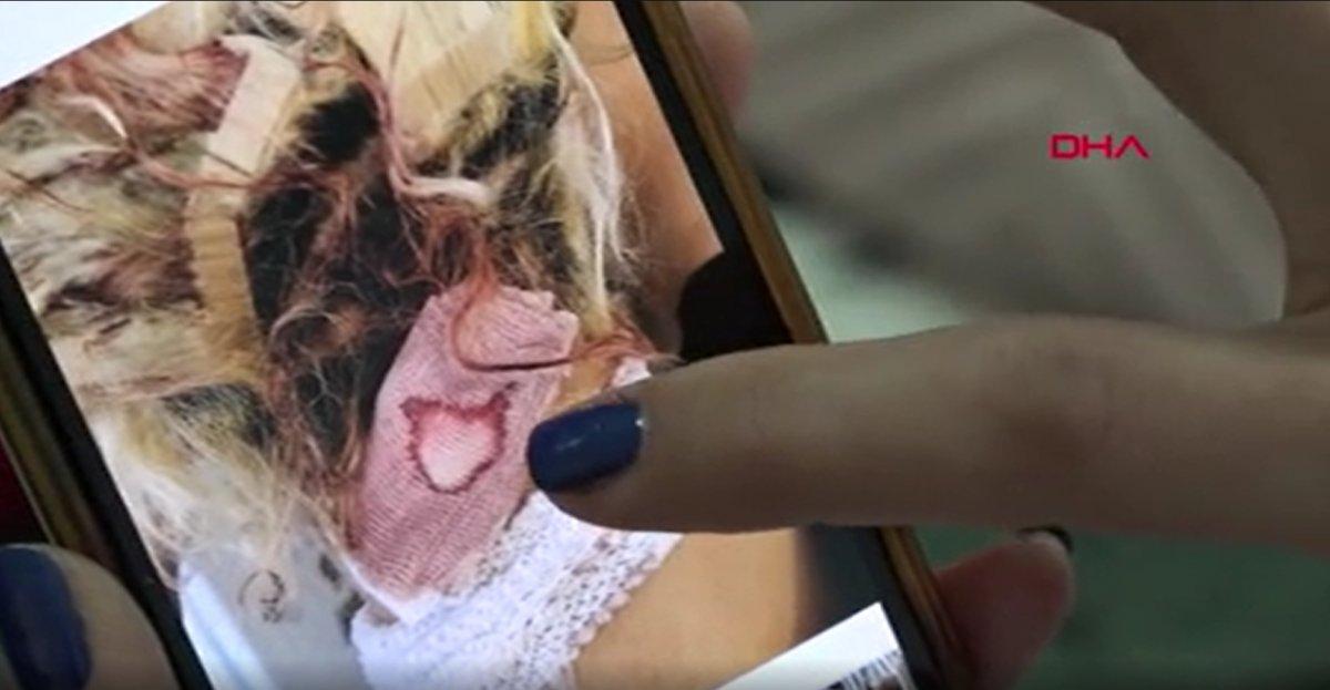 Balıkesir’de ayrılmak istediği sevgilisi, ensesinden vurdu