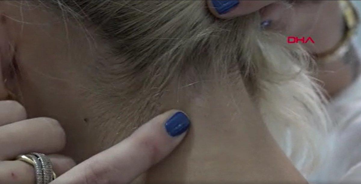 Balıkesir’de ayrılmak istediği sevgilisi, ensesinden vurdu