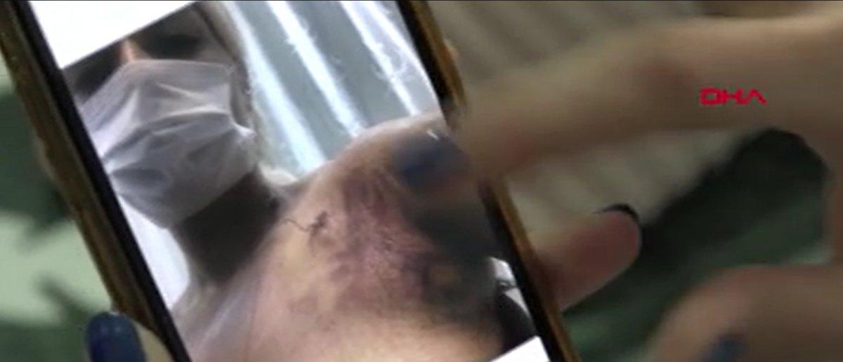 Balıkesir’de ayrılmak istediği sevgilisi, ensesinden vurdu