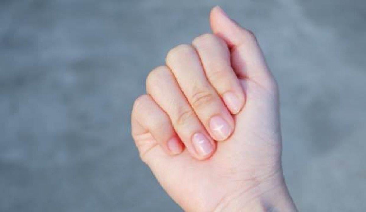 Tırnaklarda oluşan çizgilerin nedenleri