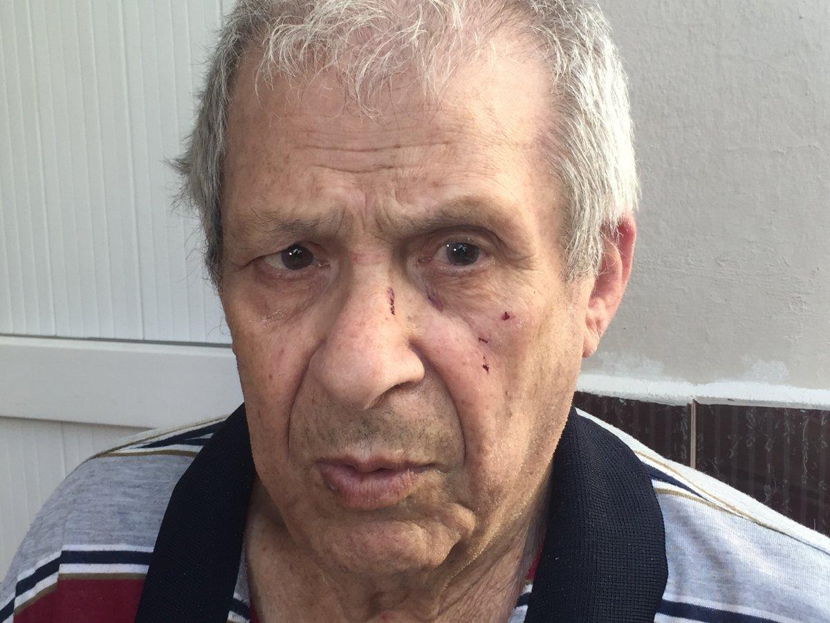 Adana'da para vermeyen dedesini dövüp, kör etti