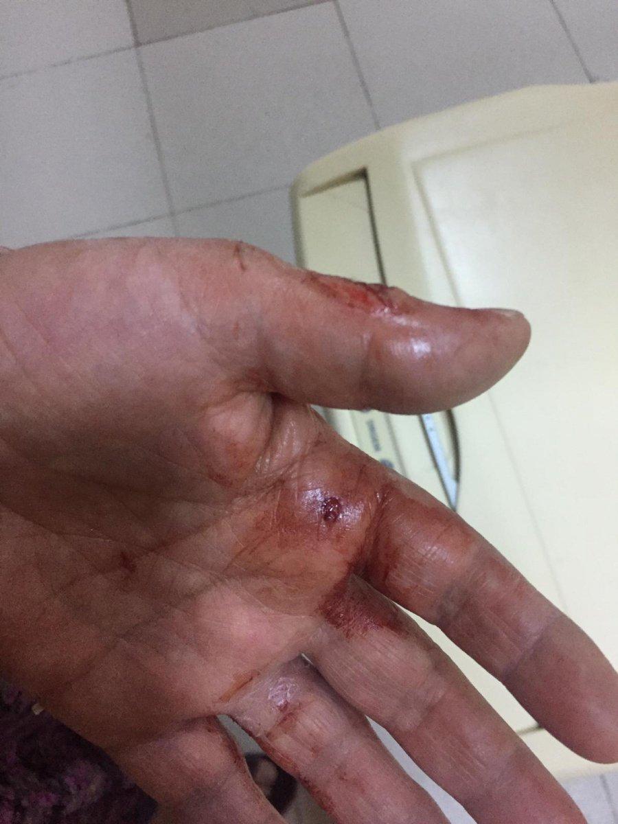 Balıkesir'de engelli kadına darp: Bana çok işkence yaptılar