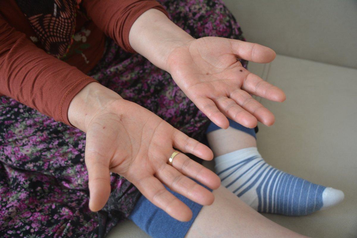 Balıkesir'de engelli kadına darp: Bana çok işkence yaptılar