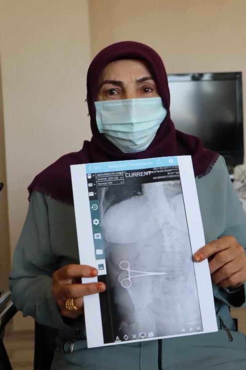 Aydın'da karnında unutulan makasla iki ay yaşadı