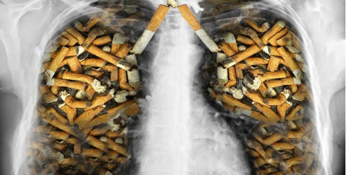 31 Mayıs Dünya Sigara İçmeme Günü nedir