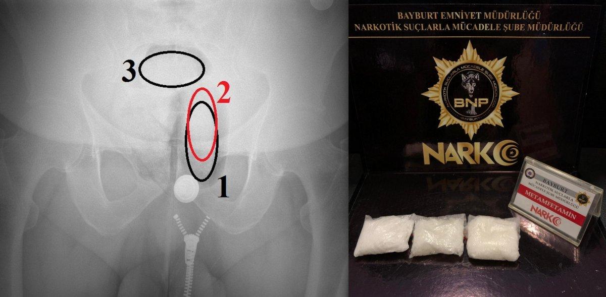 Bayburt’ta uyuşturucuyu anüs bölgesine sakladı