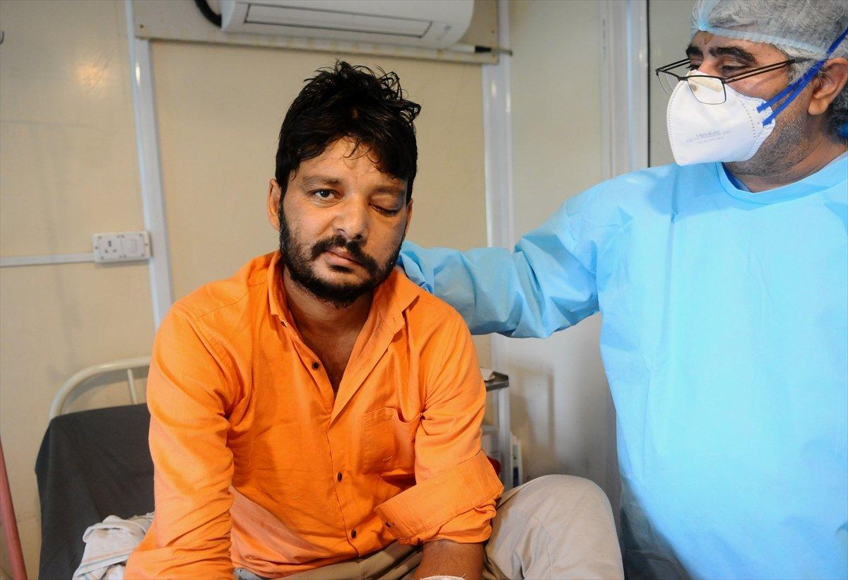 Siyah Mantar hastalığı Irak'a da sıçradı