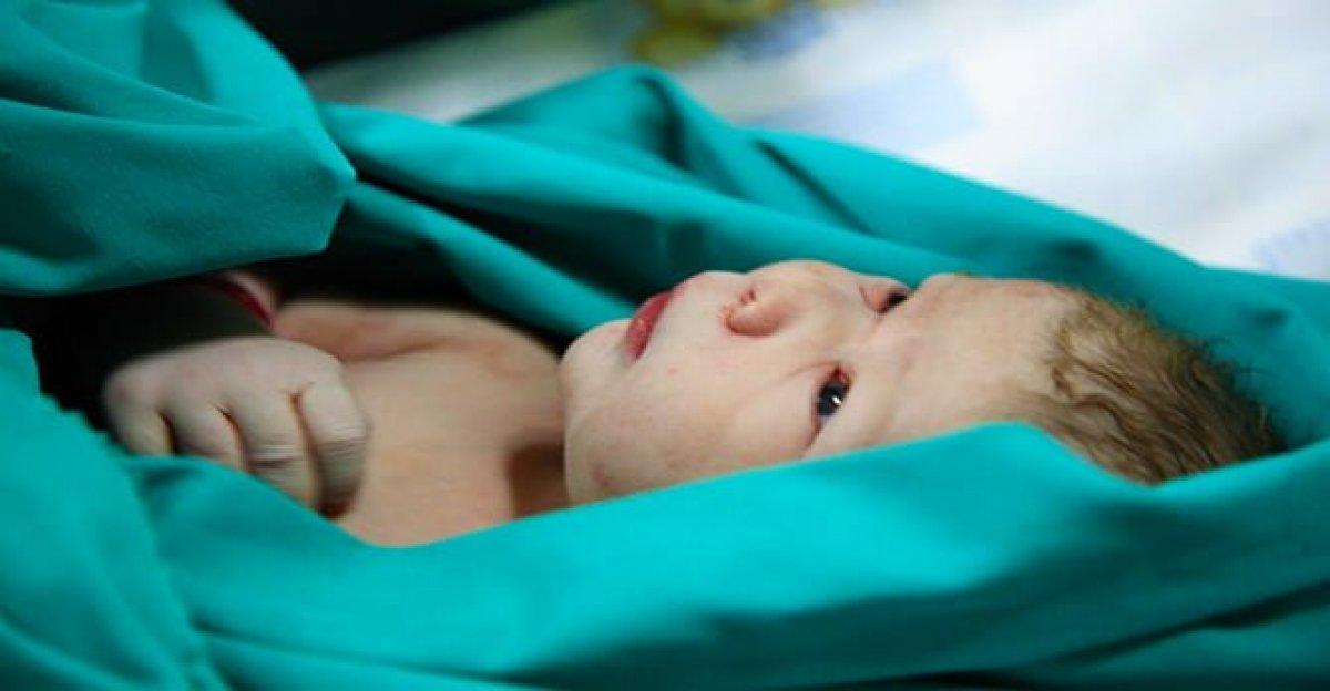 1 Haziran Dünya Fenilketonüri Günü: Fenilketonüri nedir, belirtileri nelerdir?