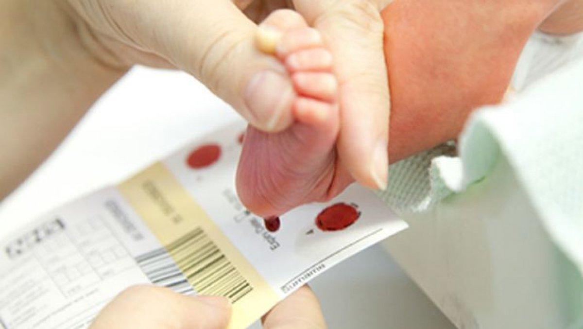 1 Haziran Dünya Fenilketonüri Günü: Fenilketonüri nedir, belirtileri nelerdir?