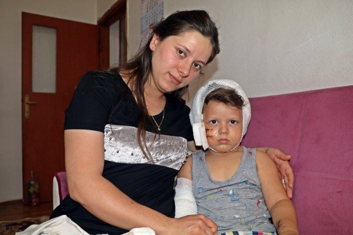 Antalyalı Yağız'ın köpek saldırısına uğradığı anlar