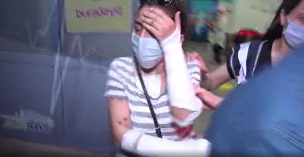 Kahramanmaraş’ta eski sevgilisinin yüzüne kezzap döken kadın tahliye oldu