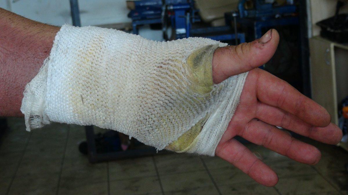 İzmit'te kaputu açılan otomobilin su kazanı patladı