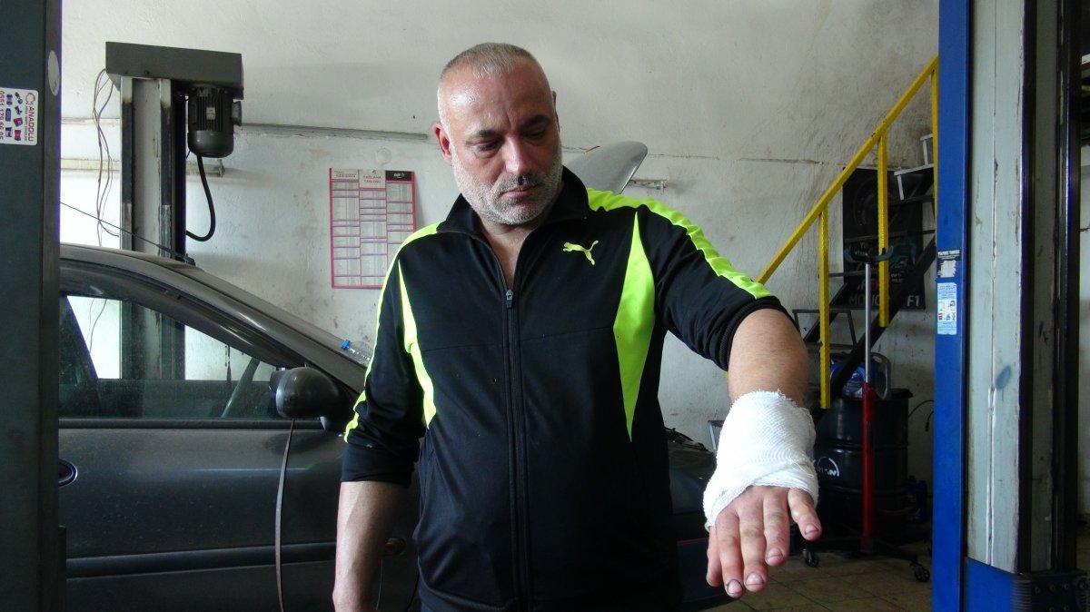 İzmit'te kaputu açılan otomobilin su kazanı patladı