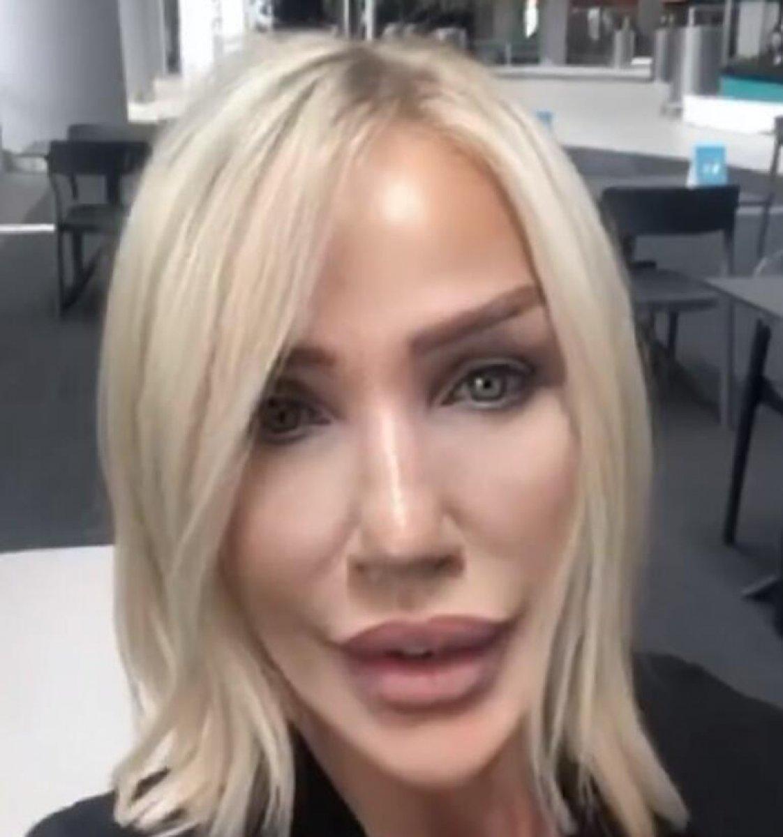 Mehmet Ali Erbil, estetik kliniğinde