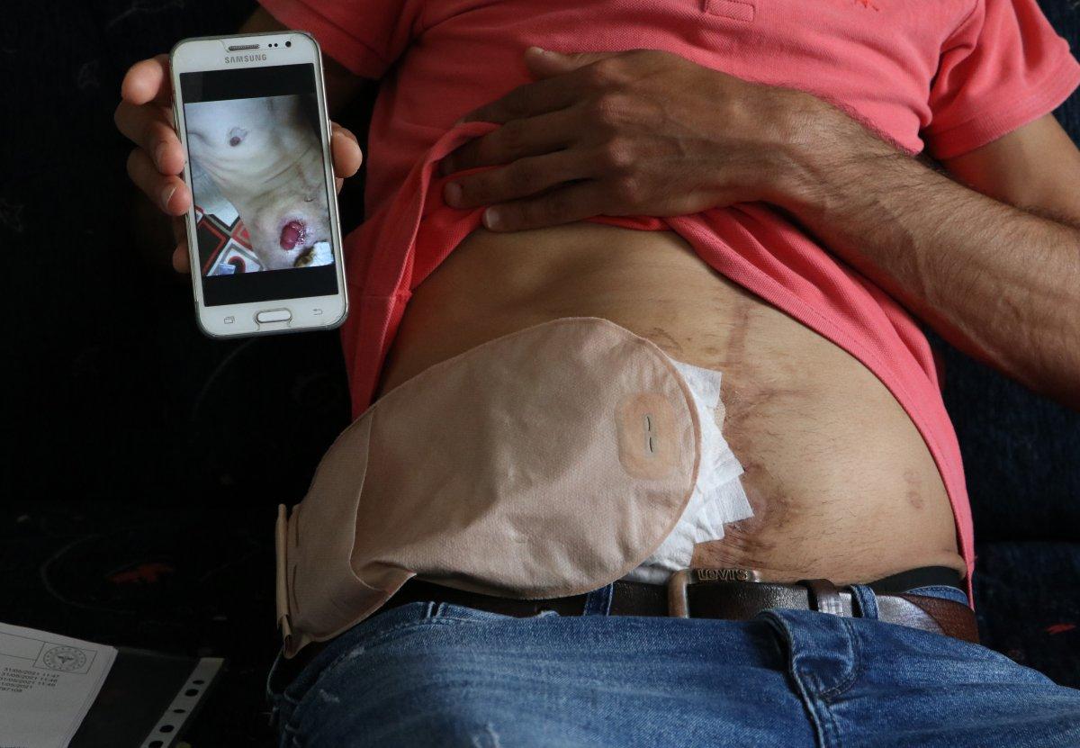 Adana'da bağırsakları dışarıda olan adam yardım bekliyor