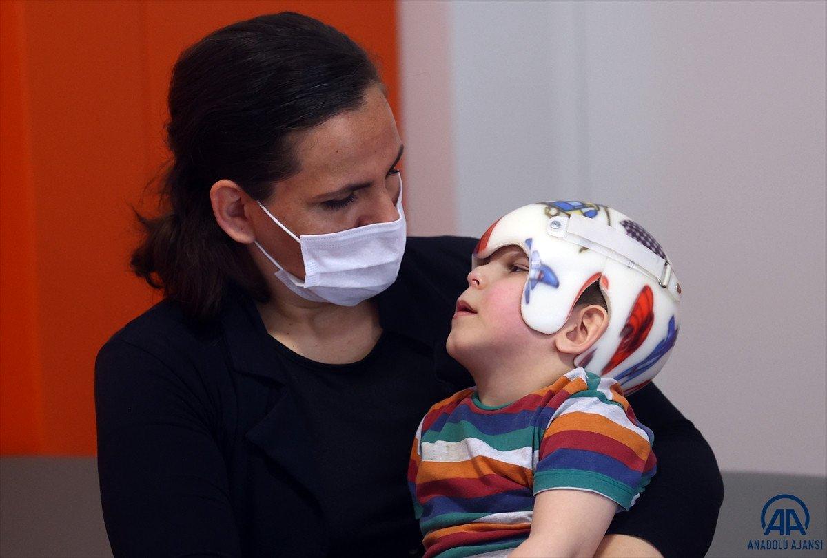 Ameliyatla ayrılan siyam ikizleri 3 yaşına girdi