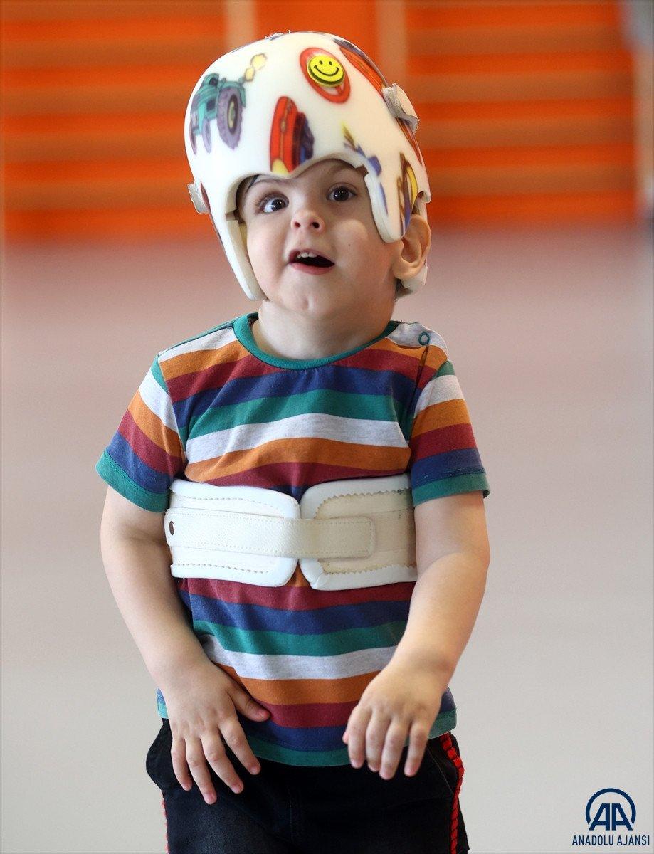 Ameliyatla ayrılan siyam ikizleri 3 yaşına girdi