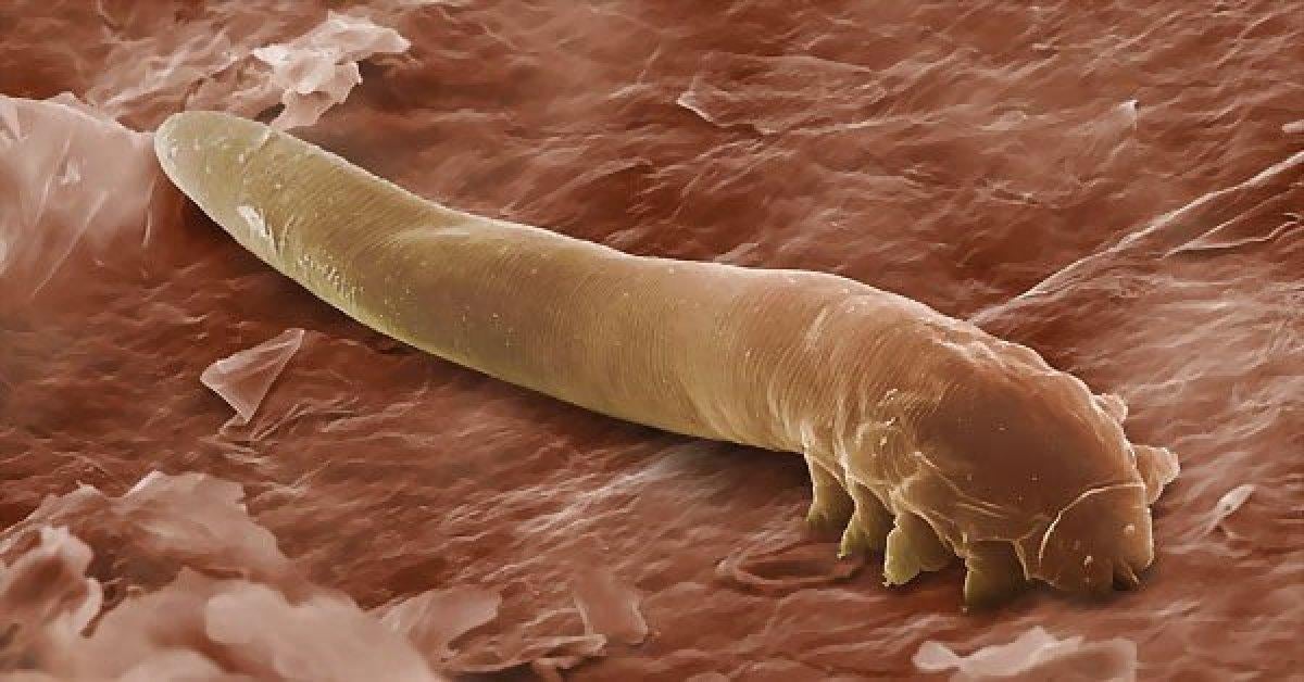 Bağırsak parazitlerine karşı doğal çözümler