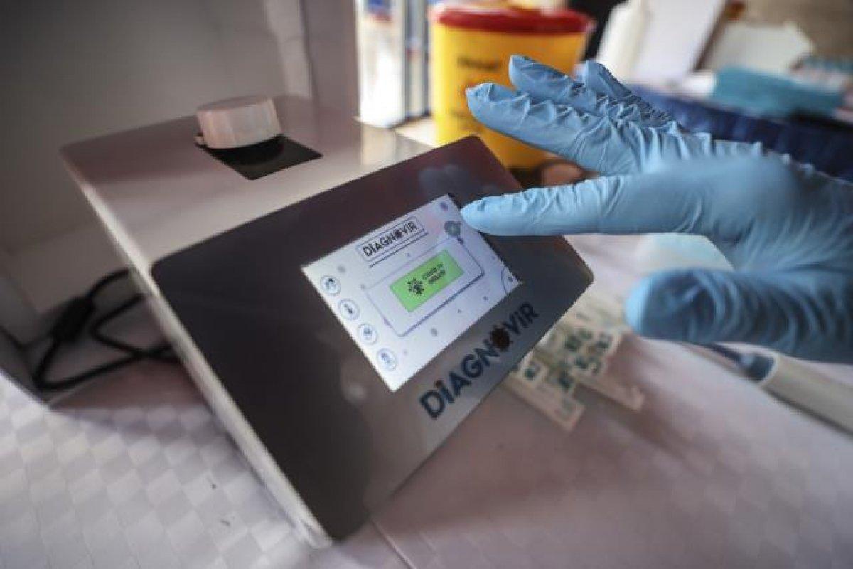 Koronavirüs teşhisini 10 saniyeye düşüren yerli test kullanımda