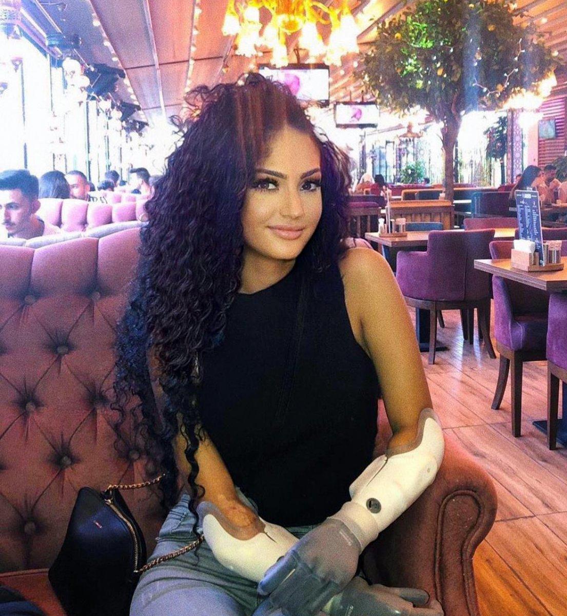 Almanya'dan Antalya'ya kol nakli olmak için geldi