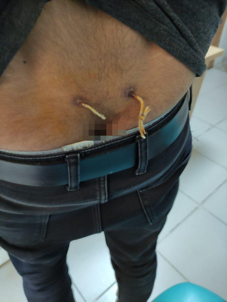 Elazığ'da ağrıları geçsin diye belinden çamaşır ipi geçirdiler