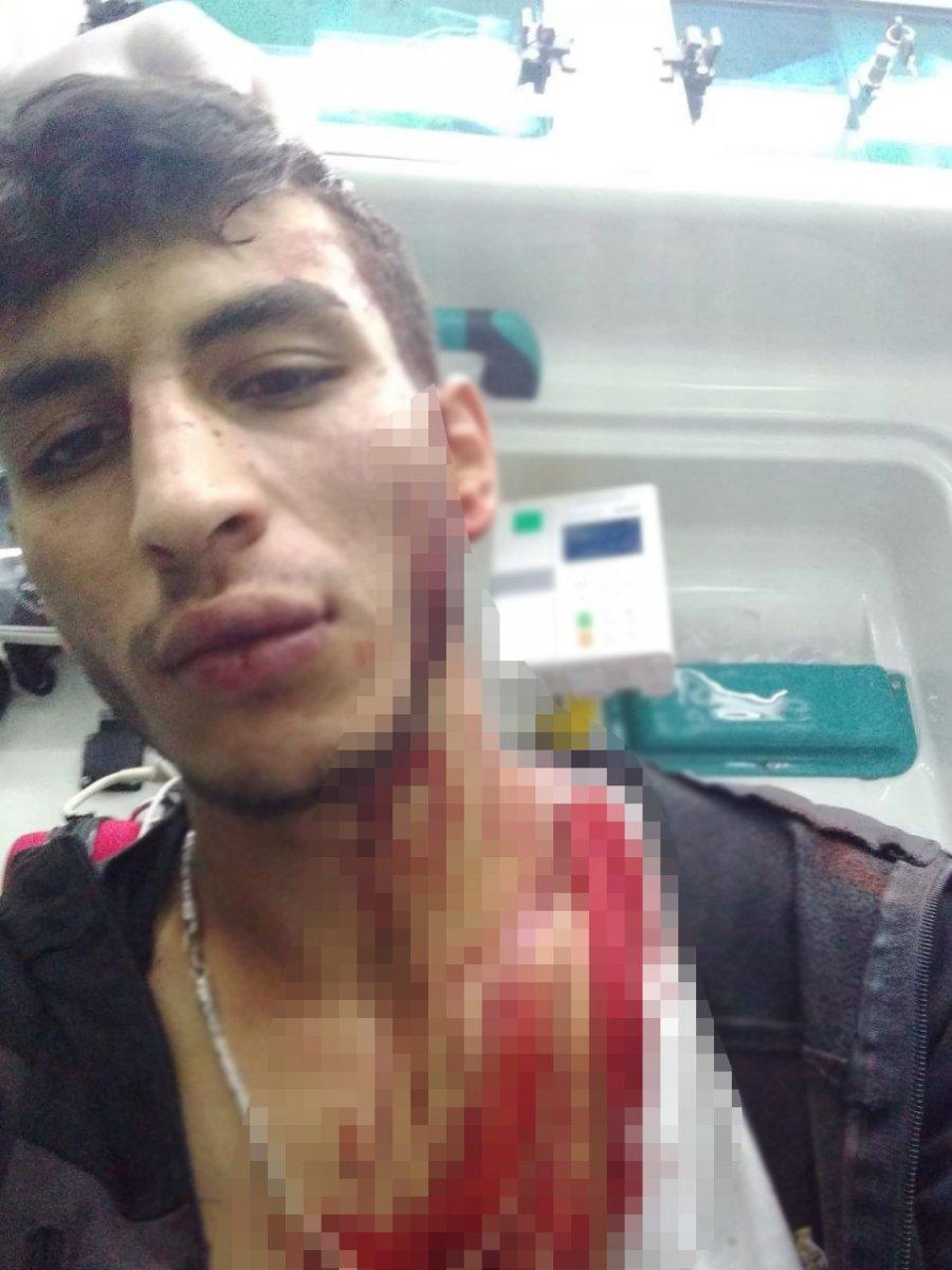 Sivas’ta düğün konvoyunun önünü kesince saldırıya uğradılar