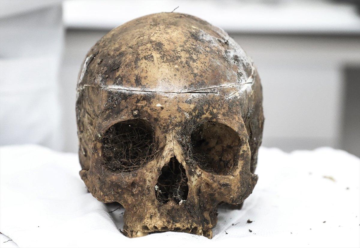 Adli Tıp morgunun kemikten doku temizleyen böcekleri