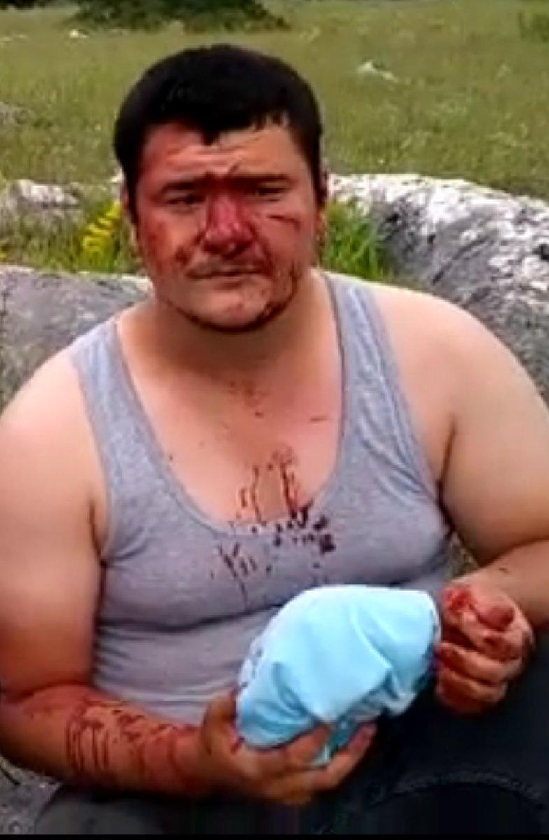 Saldırıya uğrayan İHA muhabiri Mustafa Uslu, görevinin başına döndü