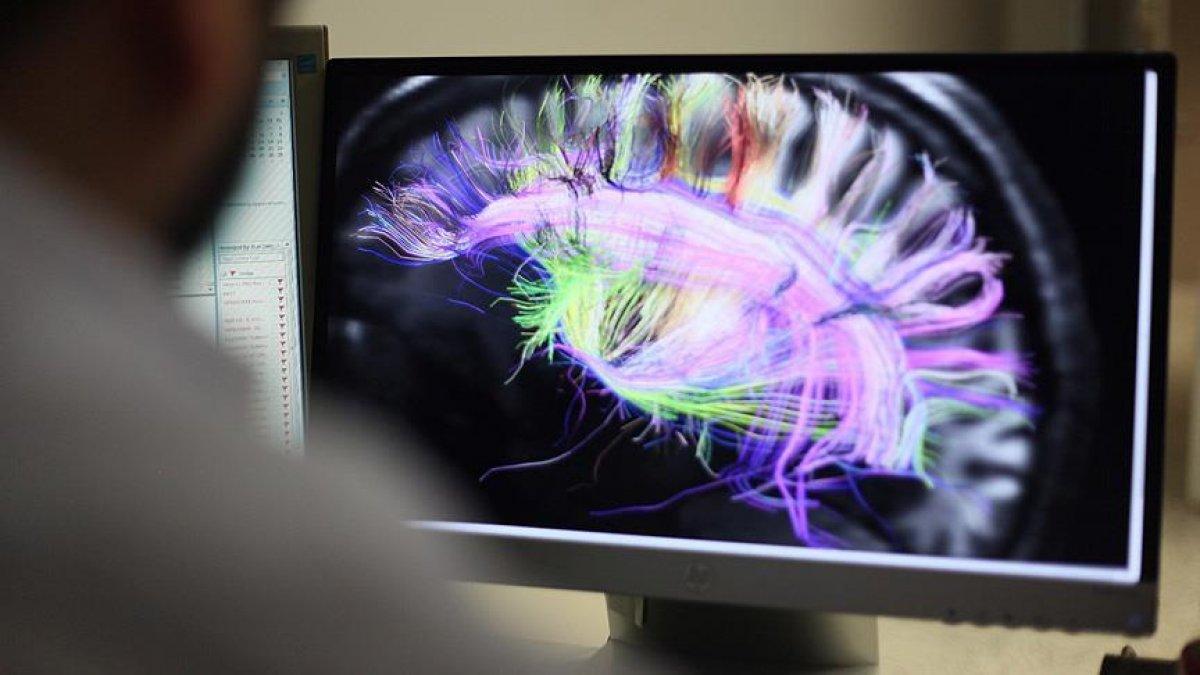 İleri yaşlarda daha sağlıklı bir beyin için 7 ipucu