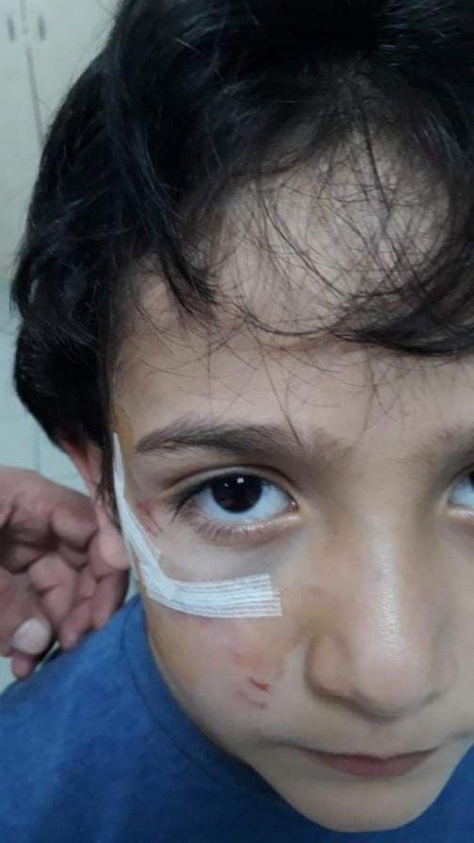 Bursa’da sokak köpeği 8 yaşındaki çocuğa saldırdı