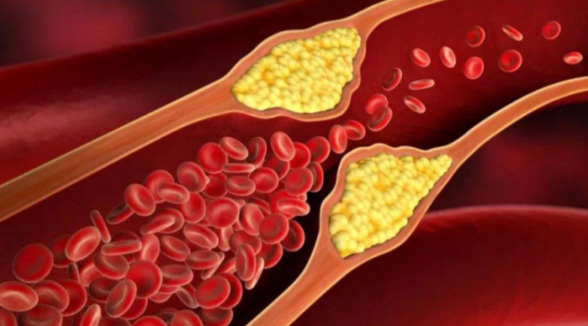 İleri yaşlarda daha sağlıklı bir beyin için 7 ipucu