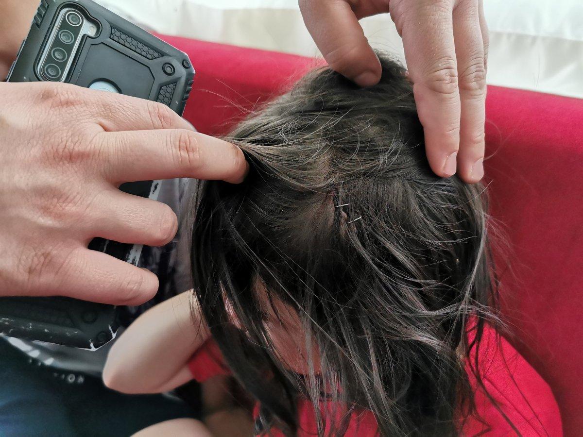 Afyonkarahisar'da sokak köpeği çocuğa saldırdı