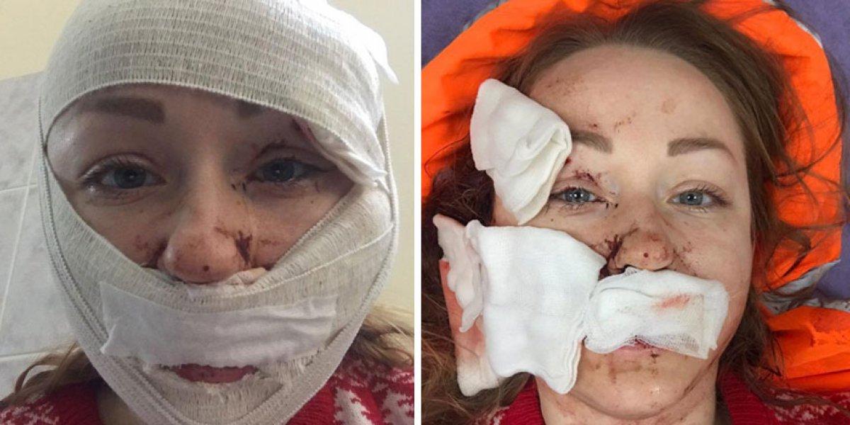 Bakırköy'de boşanmak istediği eşi tarafından falçatalı saldırıya uğrayan kadın konuştu