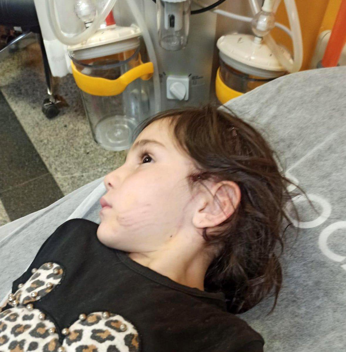 Afyonkarahisar'da sokak köpeği çocuğa saldırdı