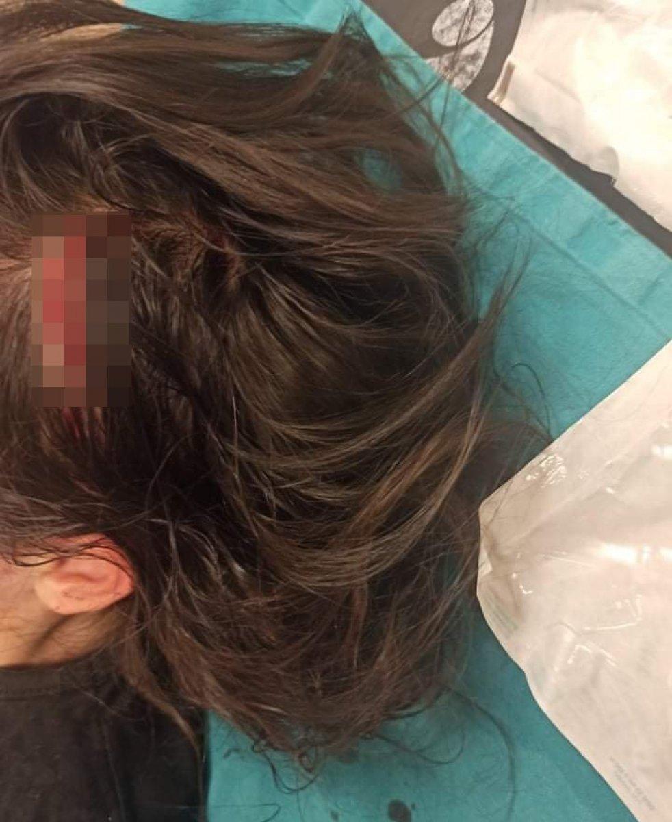 Afyonkarahisar'da sokak köpeği çocuğa saldırdı