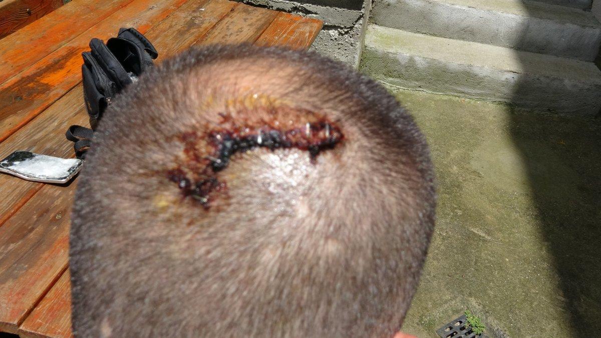 İstanbul'da beyzbol sopalı gaspçılar dehşet saçtı