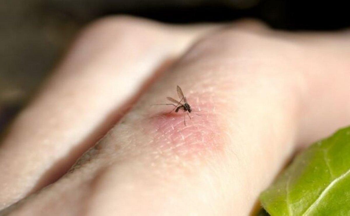 Sivrisinek ısırığına ne iyi gelir? Sivrisinek kaşıntısını geçiren yöntemler