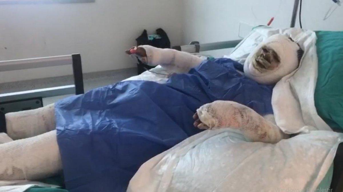 Mersin'de eski damadı tarafından benzinle yakıldı