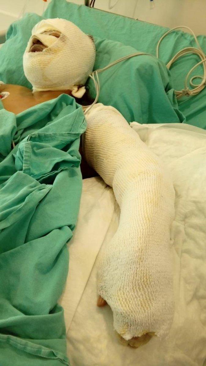 Mersin'de eski damadı tarafından benzinle yakıldı