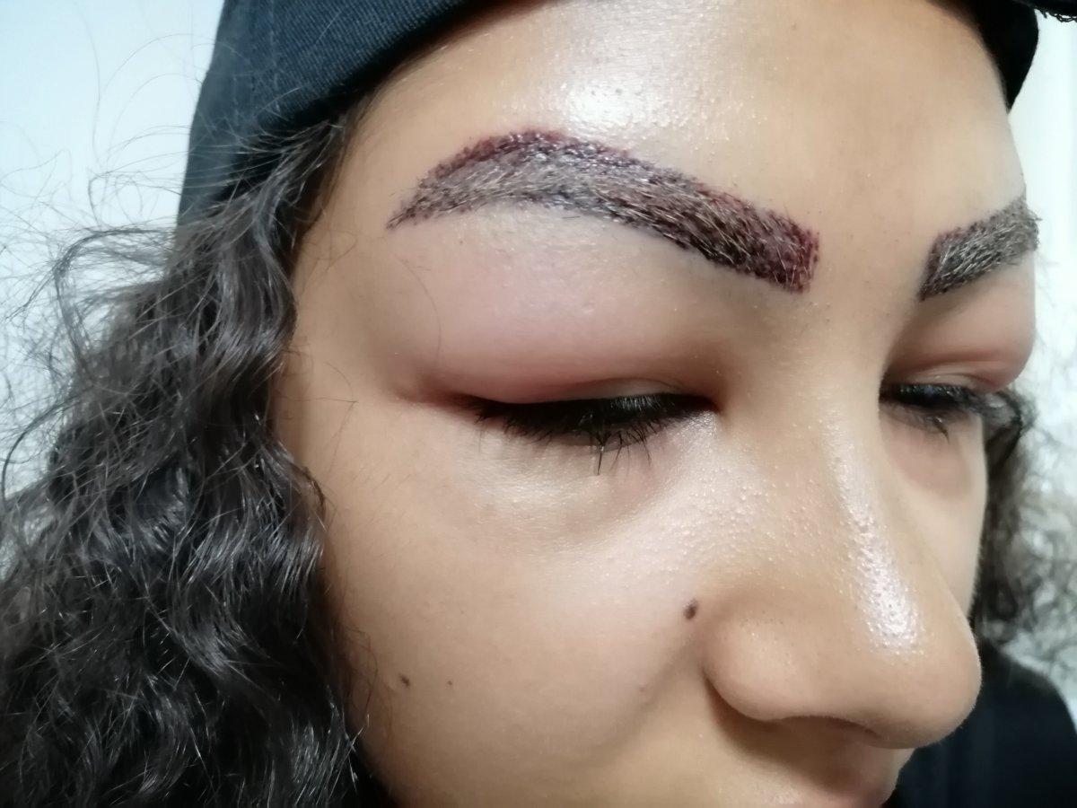 Aksaray'da reklam yüzü olmaya gitti, hastanelik oldu